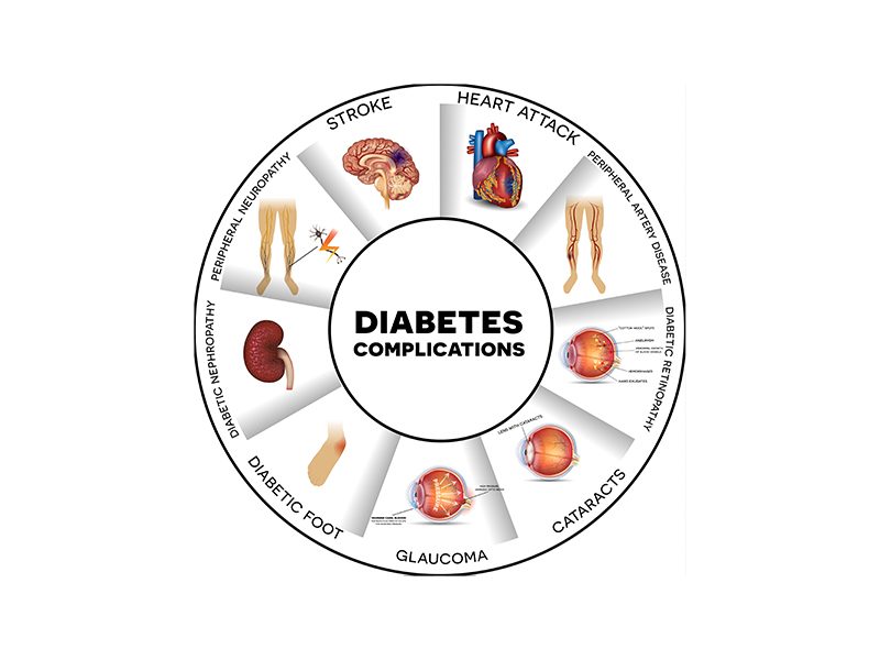 Vorsorge, Prävention und Nachhaltigkeit bei Diabetes Typ 2, Burnout, Adipositas (Übergewicht), Herz-Kreislauf durch Ernährung Abnehmen, Gewichtsreduktion, Bewegung, Sport, Stressreduktion etc. in Bonn, Köln, Düsseldorf
